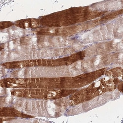 Invitrogen RASL10B Polyclonal Antibody 100 &mu;L; Unconjugated:Antibodies,