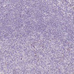 Invitrogen RASL10B Polyclonal Antibody 100 &mu;L; Unconjugated:Antibodies,