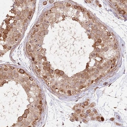 Invitrogen&trade;&nbsp;UQCC3 Polyclonal Antibody