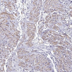 Invitrogen&trade;&nbsp;MYL6 Polyclonal Antibody