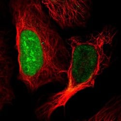 CT45A Polyclonal Antibody:Antibodies, Polyclonal
