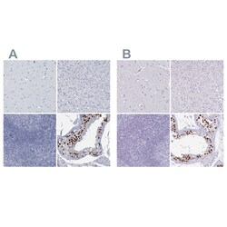 Invitrogen CT45A Polyclonal Antibody 100 &mu;L; Unconjugated:Antibodies,