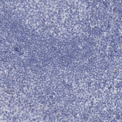 Invitrogen CT45A Polyclonal Antibody 100 &mu;L; Unconjugated:Antibodies,