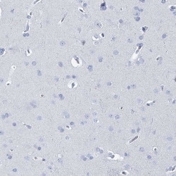 Invitrogen CT45A Polyclonal Antibody 100 &mu;L; Unconjugated:Antibodies,