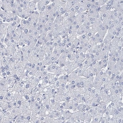 Invitrogen CT45A Polyclonal Antibody 100 &mu;L; Unconjugated:Antibodies,