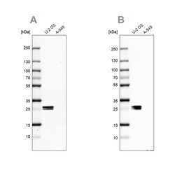 Invitrogen CT45A Polyclonal Antibody 100 &mu;L; Unconjugated:Antibodies,