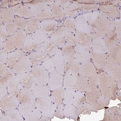 Invitrogen GNPDA2 Polyclonal Antibody 100 &mu;L; Unconjugated:Antibodies,