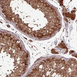 Invitrogen GNPDA2 Polyclonal Antibody 100 &mu;L; Unconjugated:Antibodies,