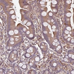 Invitrogen GNPDA2 Polyclonal Antibody 100 &mu;L; Unconjugated:Antibodies,
