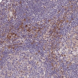 Invitrogen MAGEF1 Polyclonal Antibody 100 &mu;L; Unconjugated:Antibodies,