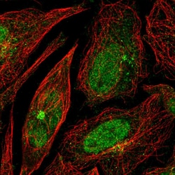 Invitrogen RPP25 Polyclonal Antibody 100 &mu;L; Unconjugated:Antibodies,