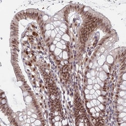 Invitrogen RPP25 Polyclonal Antibody 100 &mu;L; Unconjugated:Antibodies,