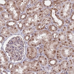 Invitrogen RPP25 Polyclonal Antibody 100 &mu;L; Unconjugated:Antibodies,