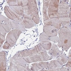 Invitrogen RPP25 Polyclonal Antibody 100 &mu;L; Unconjugated:Antibodies,
