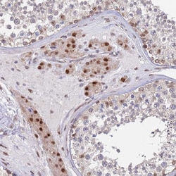 Invitrogen RPP25 Polyclonal Antibody 100 &mu;L; Unconjugated:Antibodies,