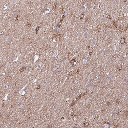 Invitrogen JAKMIP2 Polyclonal Antibody 100 &mu;L; Unconjugated:Antibodies,