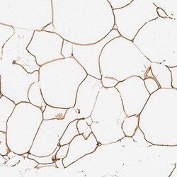 Invitrogen C19orf12 Polyclonal Antibody 100 &mu;L; Unconjugated:Antibodies,