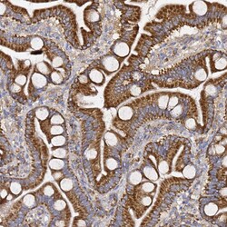 Invitrogen C19orf12 Polyclonal Antibody 100 &mu;L; Unconjugated:Antibodies,