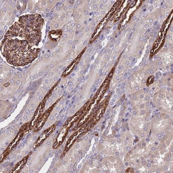 Invitrogen mPR alpha Polyclonal Antibody 100 &mu;L; Unconjugated:Antibodies,