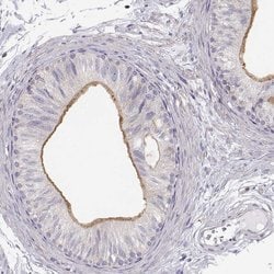 Invitrogen DAPL1 Polyclonal Antibody 100 &mu;L; Unconjugated:Antibodies,