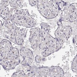 Invitrogen DAPL1 Polyclonal Antibody 100 &mu;L; Unconjugated:Antibodies,
