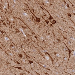 Invitrogen MCCD1 Polyclonal Antibody 100 &mu;L; Unconjugated:Antibodies,