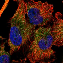 Invitrogen DDX60 Polyclonal Antibody 100 &mu;L; Unconjugated:Antibodies,