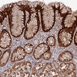 Invitrogen DDX60 Polyclonal Antibody 100 &mu;L; Unconjugated:Antibodies,