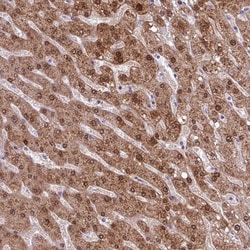 Invitrogen POLR2J Polyclonal Antibody 100 &mu;L | Buy Online | Invitrogen&trade; | Fisher Scientific