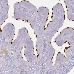 SLC44A4 Polyclonal Antibody:Antibodies, Polyclonal