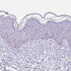 SLC44A4 Polyclonal Antibody:Antibodies, Polyclonal
