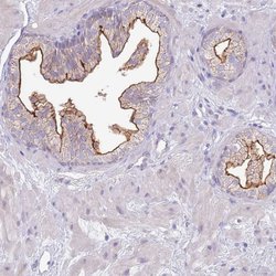 SLC44A4 Polyclonal Antibody:Antibodies, Polyclonal