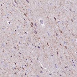 Invitrogen BRUNOL6 Polyclonal Antibody 100 &mu;L | Buy Online | Invitrogen&trade; | Fisher Scientific
