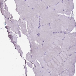 Invitrogen BRUNOL6 Polyclonal Antibody 100 &mu;L | Buy Online | Invitrogen&trade; | Fisher Scientific