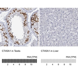 Invitrogen CT45A Polyclonal Antibody 100 &mu;L; Unconjugated:Antibodies,