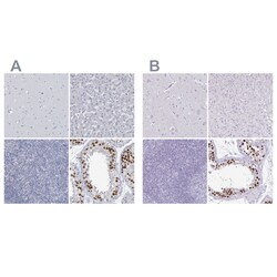 Invitrogen CT45A Polyclonal Antibody 100 &mu;L; Unconjugated:Antibodies,