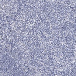 Invitrogen CT45A Polyclonal Antibody 100 &mu;L; Unconjugated:Antibodies,