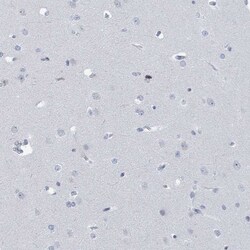 Invitrogen CT45A Polyclonal Antibody 100 &mu;L; Unconjugated:Antibodies,