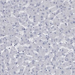Invitrogen CT45A Polyclonal Antibody 100 &mu;L; Unconjugated:Antibodies,