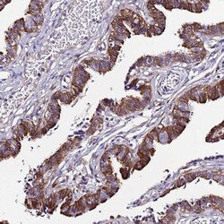 Invitrogen C19orf24 Polyclonal Antibody 100 &mu;L; Unconjugated:Antibodies,