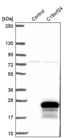 Invitrogen C19orf24 Polyclonal Antibody 100 &mu;L; Unconjugated:Antibodies,