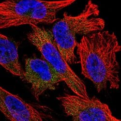 Invitrogen NUDT10 Polyclonal Antibody 100 &mu;L; Unconjugated:Antibodies,
