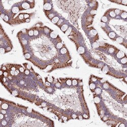 Invitrogen TYW1 Polyclonal Antibody 100 &mu;L | Buy Online | Invitrogen&trade; | Fisher Scientific