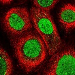 Invitrogen TRMT6 Polyclonal Antibody 100 &mu;L; Unconjugated:Antibodies,