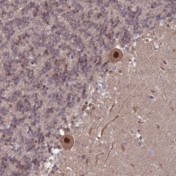 Invitrogen TRMT6 Polyclonal Antibody 100 &mu;L; Unconjugated:Antibodies,