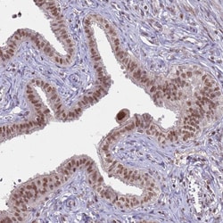 Invitrogen TRMT6 Polyclonal Antibody 100 &mu;L; Unconjugated:Antibodies,