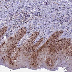 Invitrogen TRMT6 Polyclonal Antibody 100 &mu;L; Unconjugated:Antibodies,
