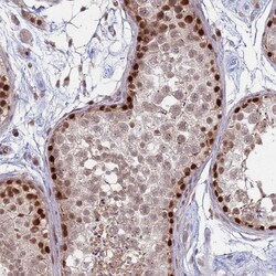 Invitrogen TRMT6 Polyclonal Antibody 100 &mu;L; Unconjugated:Antibodies,