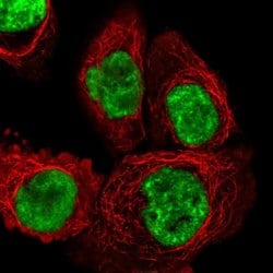 Invitrogen DHX15 Polyclonal Antibody 100 &mu;L; Unconjugated:Antibodies,