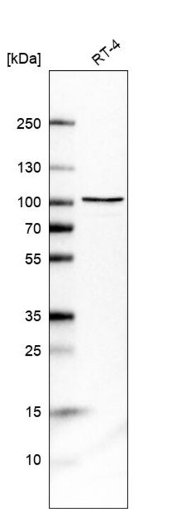 Invitrogen DHX15 Polyclonal Antibody 100 &mu;L; Unconjugated:Antibodies,